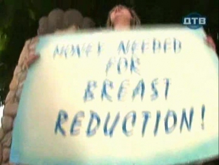 apply for breast reduction